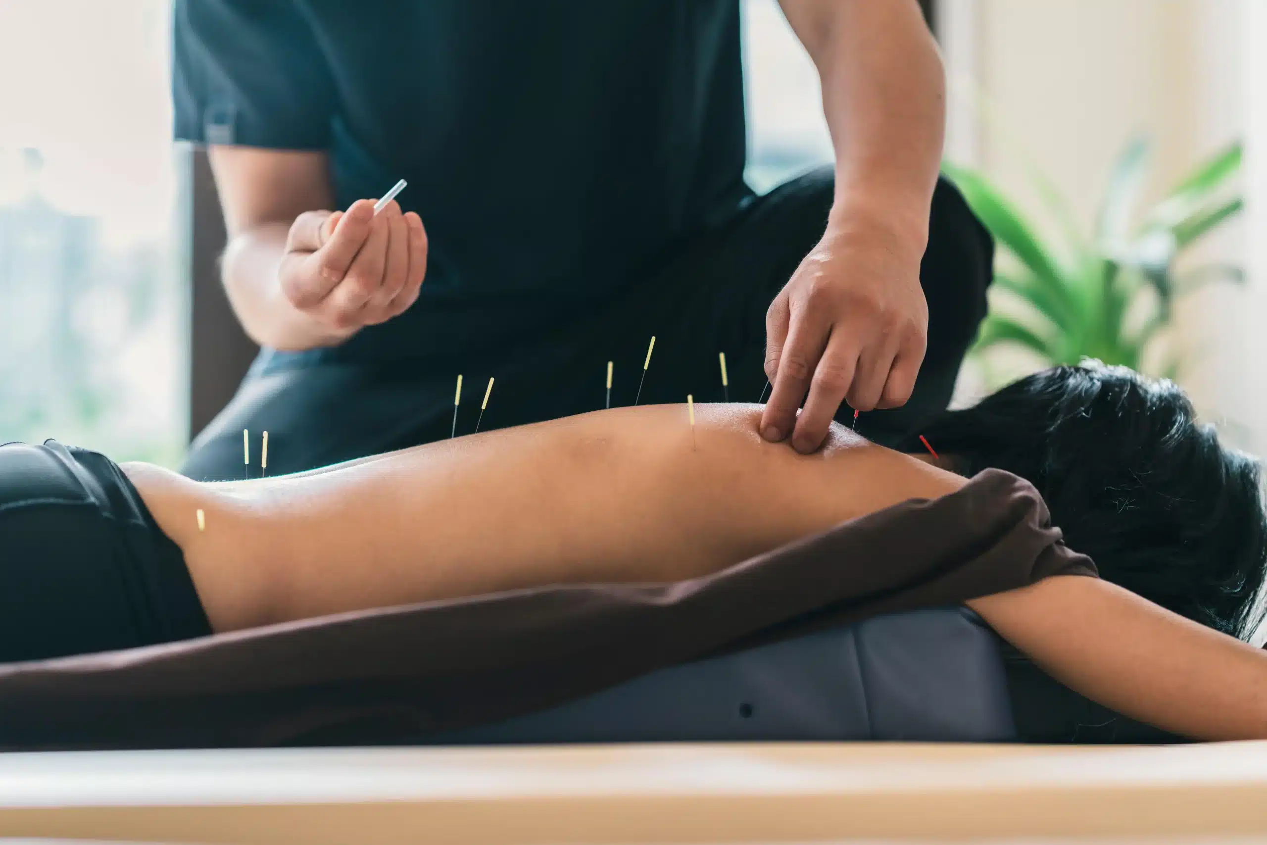 Therapist giving acupuncture treatment to a woman at Well in Montclair in Montclair, New Jersey.